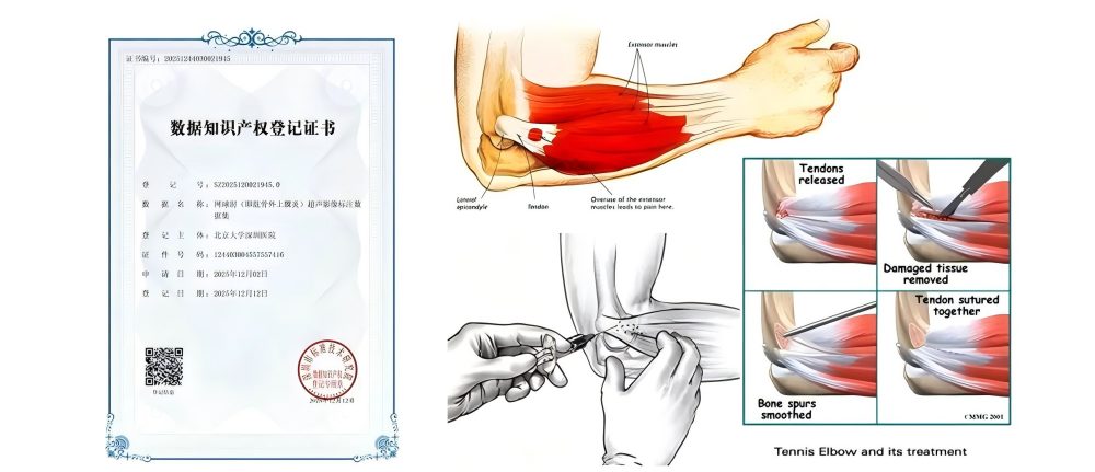 北大深圳医院运动医学与康复医学中心斩获首张知识产权证书 医学中心助力科研成果转化新突破