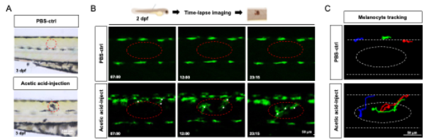 医学中心生物医学研究所阎言课题组合作揭示成纤维细胞调控炎症后色素沉着新机制(图2) 图片 2.png