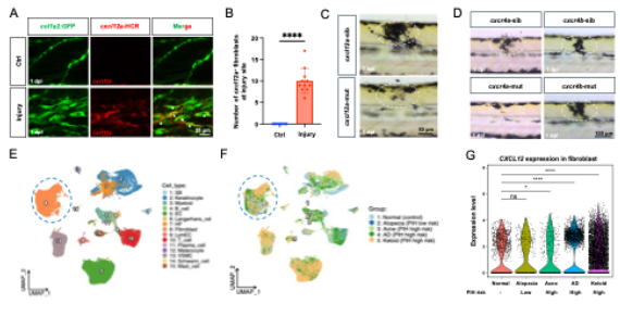 医学中心生物医学研究所阎言课题组合作揭示成纤维细胞调控炎症后色素沉着新机制(图4) 图片 4.png
